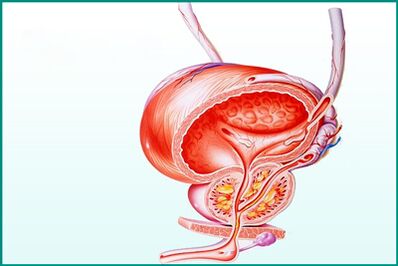 Възпалението на простатата при остър простатит е ограничение за секс